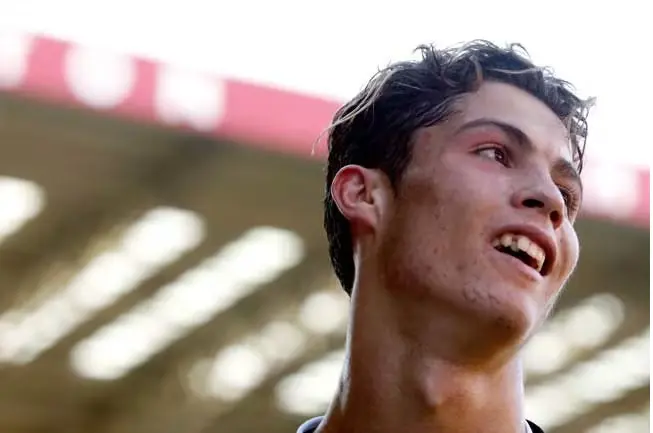 Manchester United's Ronaldo had a bad teeth in his early years for Manchester United