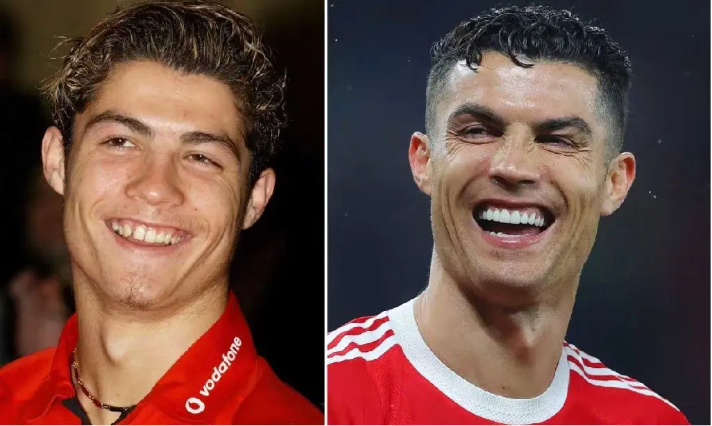 Cristiano Ronaldo's teeth has evolved over the years from being uneven to perfectly white