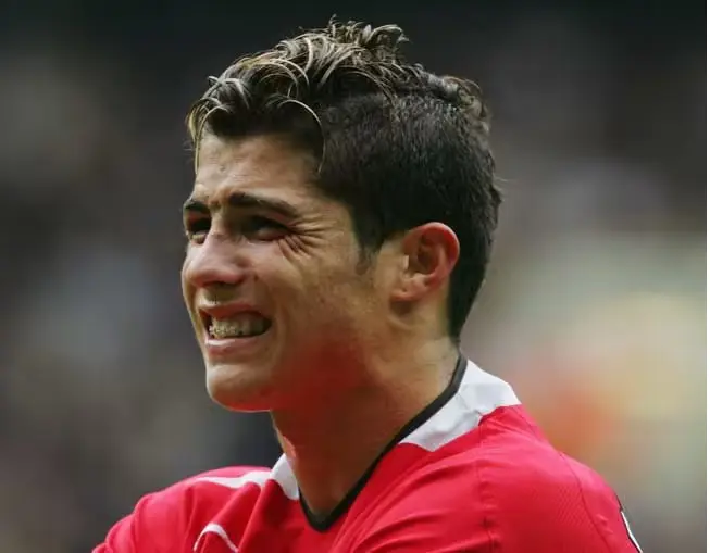 Ronaldo seen with his ceramic braces during his match for Manchester United
