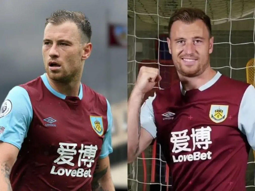 EFL side Burnley forward Ashley Barnes underwent a transplant in 2017. The above two pictures depicts him before and after the procedure.