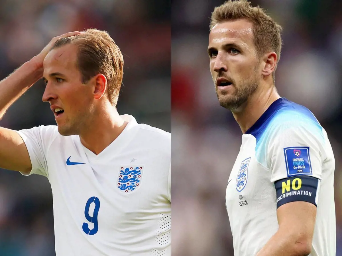 Harry Kane with the English national team before and after.