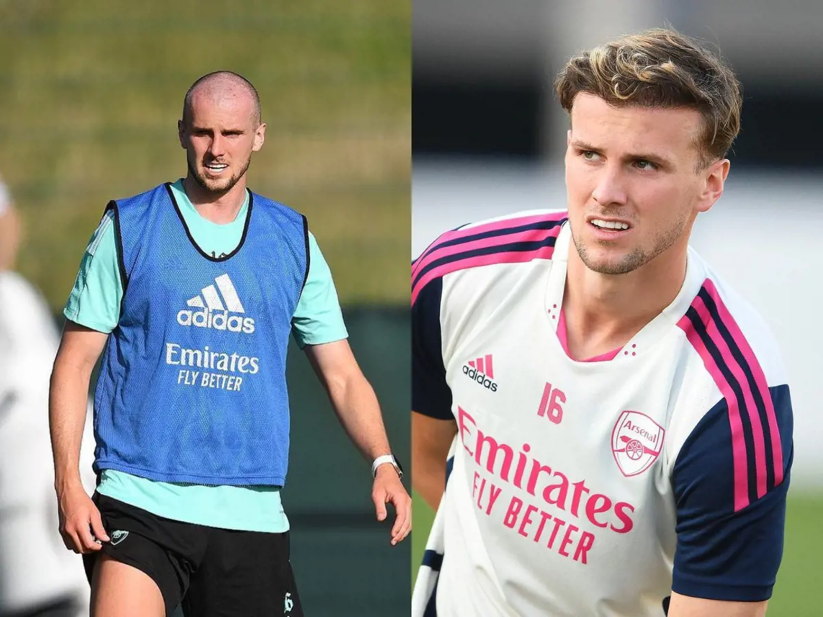 Rob Holding with a shaved head at Arsenal training ground in July 2021 vs him with head full of hair after transplant.