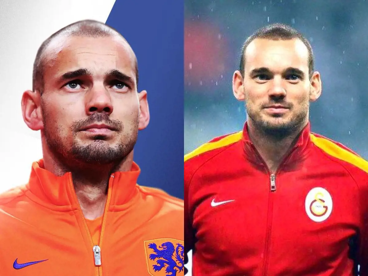 Wesley Sneijder hair looked a bit thicker after he a treatment in 2014 compared to his photo on the left