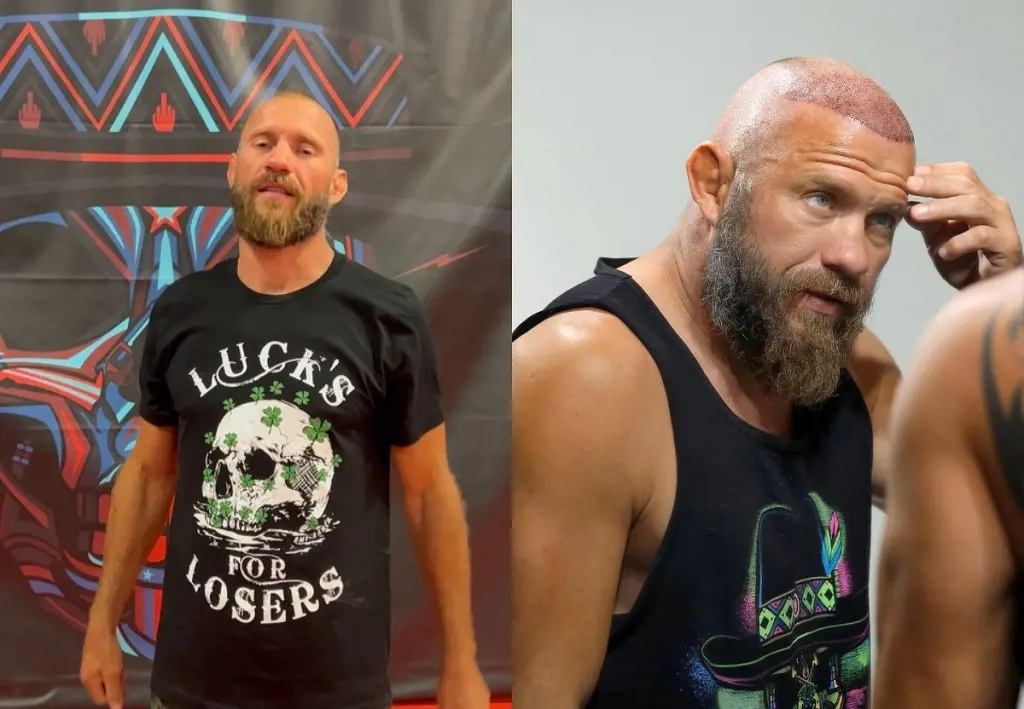 Before and after photo of Cerrone hairline restoration